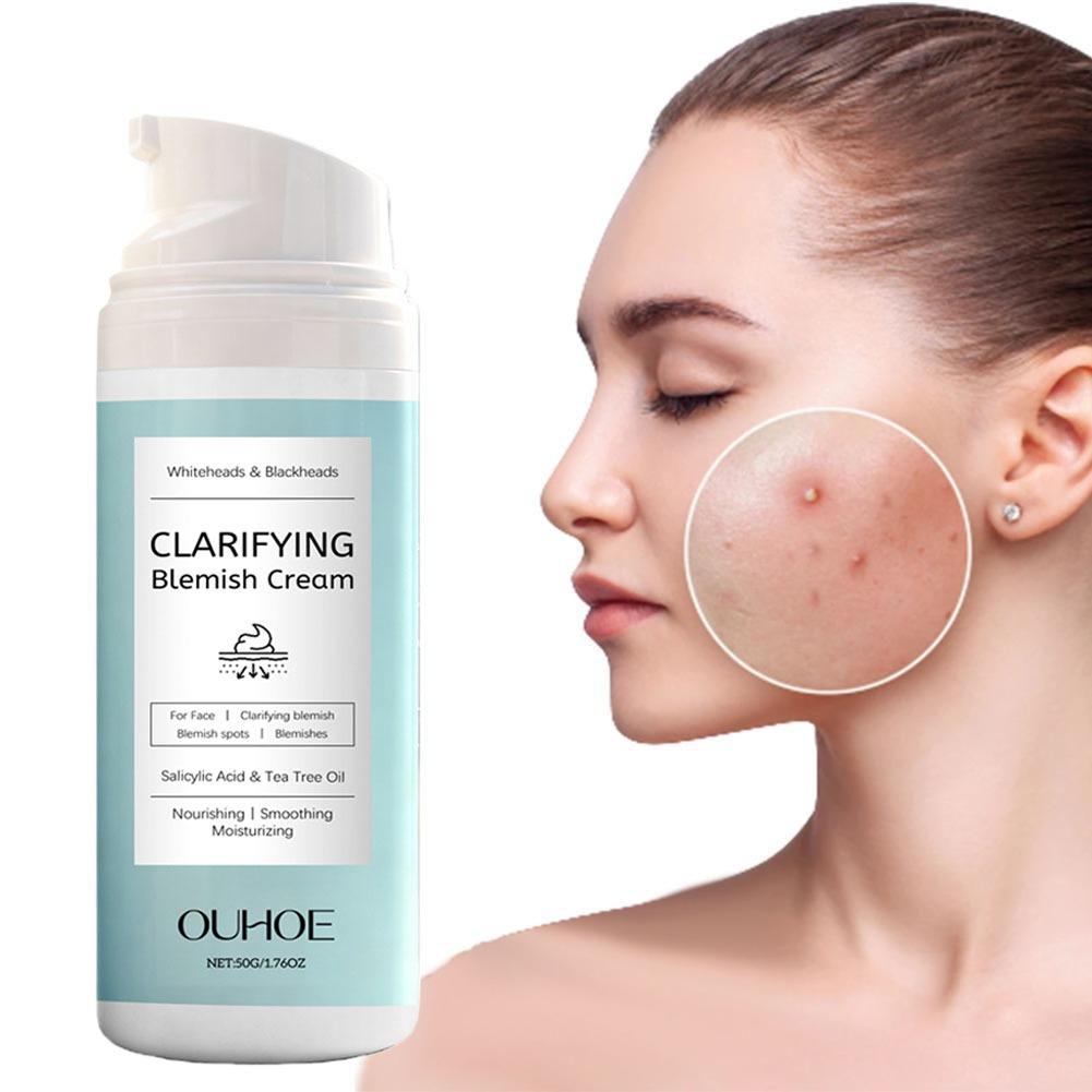 Salicylic Acid Blackhead Remover - Salicylzuur Acne Verwijderende Crème Voedende Lichtgewicht