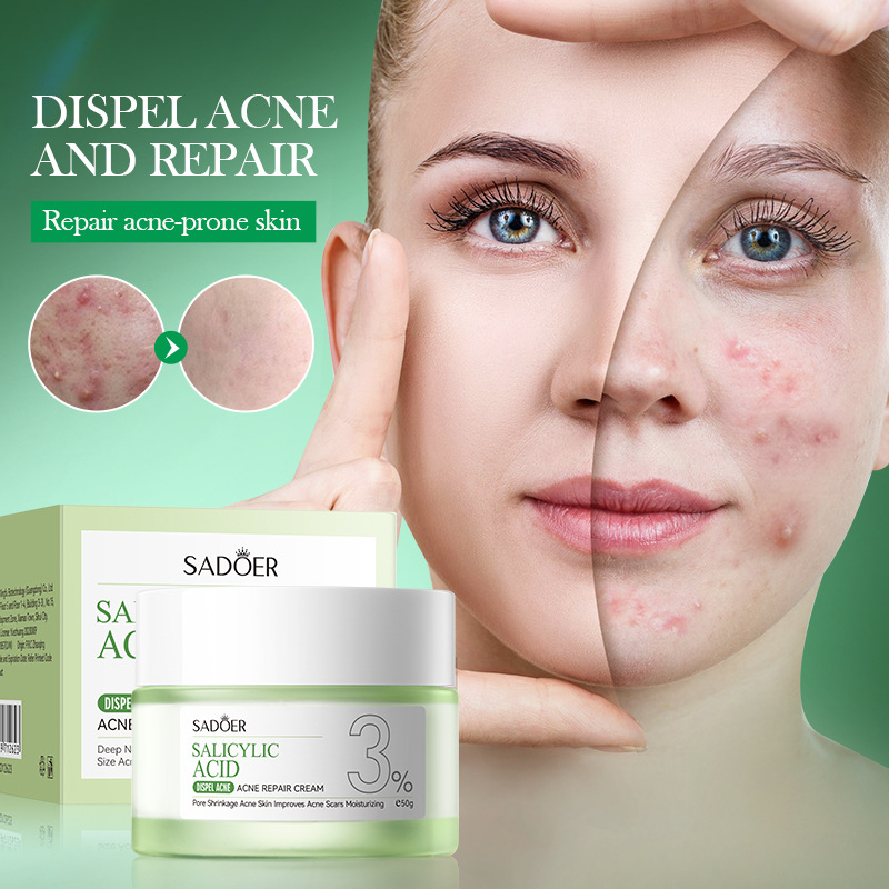 Salicylzuur Acne Behandeling C - Salicylic Acid Blackhead Remover recensie en prijs